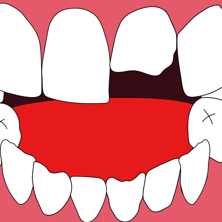 Dentistry illustration by Kaelen Felix for 360 Magazine
